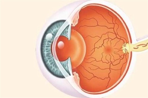 青光眼是怎么回事什么症状?老年人得青光眼建议做手术吗
