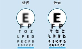 儿童散光矫正会自愈吗？矫正一般多少钱？几岁矫正合适？