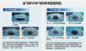 普瑞眼科近视手术怎么样？普瑞眼科技术娴熟近视手术价格8750起