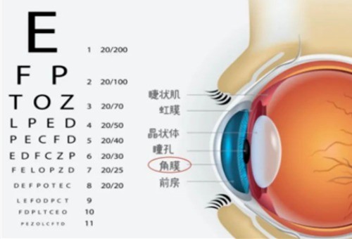 内行人在线为你解答!眼角膜有点薄适合做飞秒手术吗?