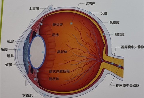 眼睛玻璃体混浊会自愈吗？不会 及早治疗才是正解