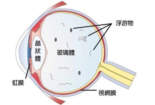南宁普瑞眼科医院怎么样?普瑞眼科虽是私立眼科但很正规,附简介+地址+口碑!