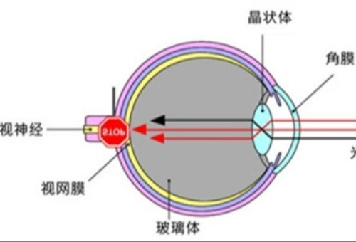 青光眼到最后都是瞎吗？我想知道青光眼是不是早晚都要瞎！