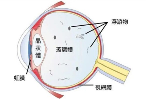 光明眼科医院正规吗?光明眼科医院是私立连锁眼科,但正规且收费不贵!