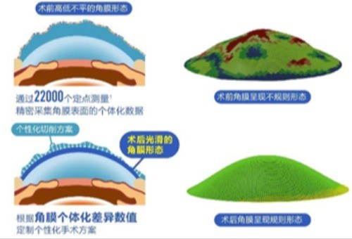 纯分享!!!尖峰眼科医院怎么样？可靠吗？尖峰眼科看眼科很不错