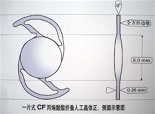 一片式人工晶体