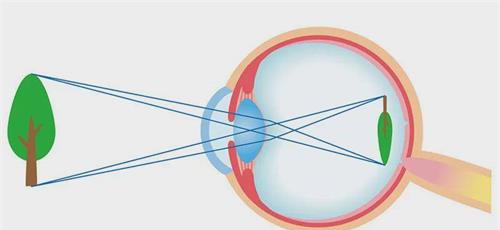 近视眼视物示意图