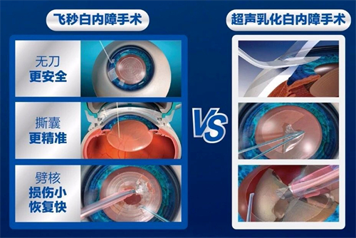 飞秒白内障手术区别