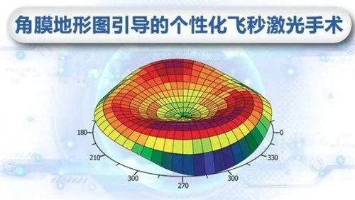 角膜地形图