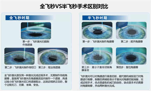 全飞秒半飞秒手术区别对比图