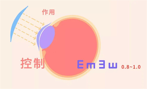 OK镜有必要带进口的吗？国产ok镜和进口ok镜差别有啥？