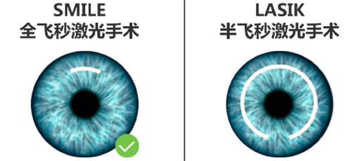全飞和半飞方式区别图