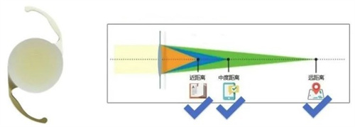 三焦点人工晶体拥有广泛的聚焦范围