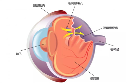 眼部结构图