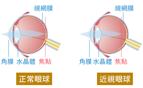 2023年终盘点全飞秒近视手术价格一览表!附技术原理介绍~