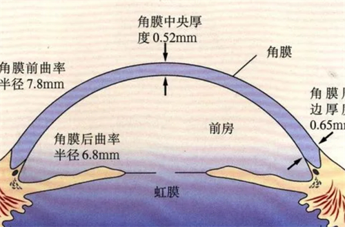 圆锥角膜数据分析图解