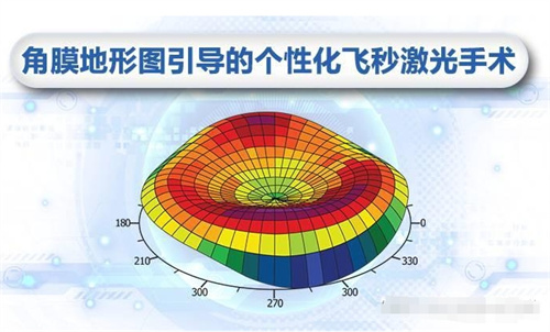 绿飞秒示意图