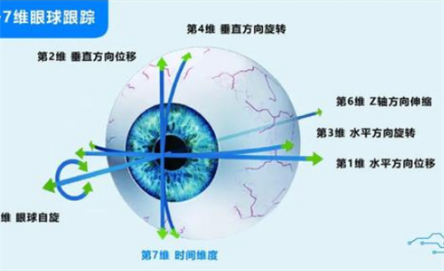 千频优视近视手术优势介绍图解