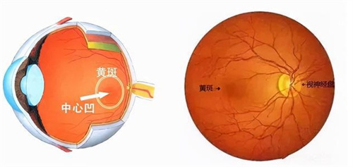 黄斑病变结构图