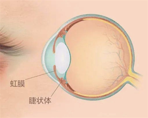 ​虹膜炎眼睛是怎样引起的，如何治疗，原因及治疗方法分享！
