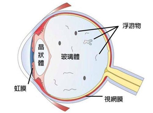 玻璃体图示