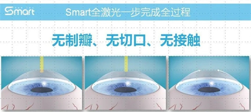 全飞秒手术优势