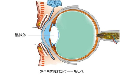 晶状体部位展示图