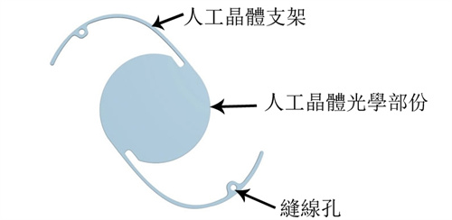 进口人工晶体和国产人工晶体的区别!材料选择/制作工艺/收费价格都不同!