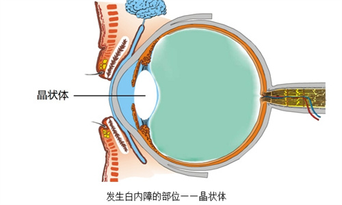 发生白内障部位动画图