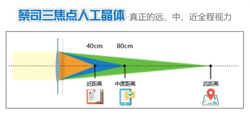 蔡司三焦点人工晶体