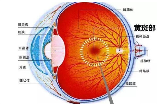 眼白上有黄斑是怎么回事?要紧吗?可能是黄斑病变建议早发现早治疗!