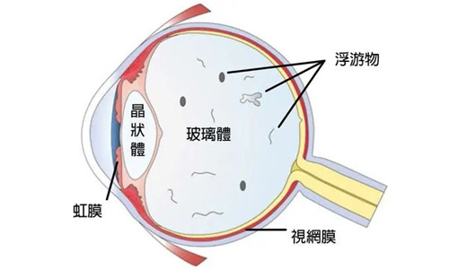 眼球玻璃体位置展示图