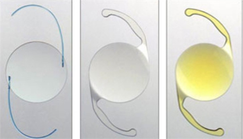 白内障晶体类型有哪些，硬性/折叠型/非球面形/可调节型人工晶体任你选择！