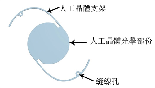 白内障晶体结构图