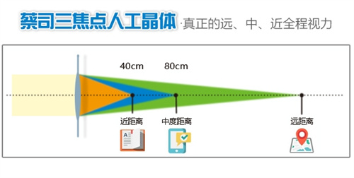 三焦点人工晶体示意图