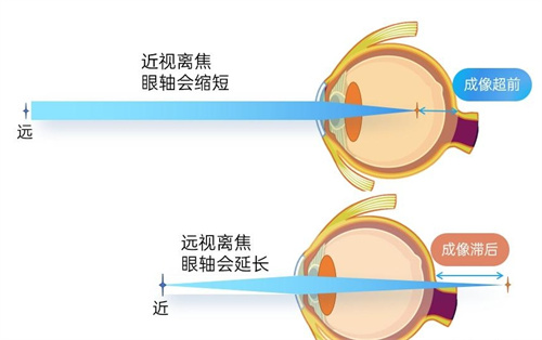 雾视镜治疗对比图