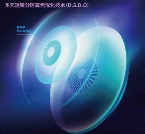 奥拉怒放离焦防控镜片宣传图