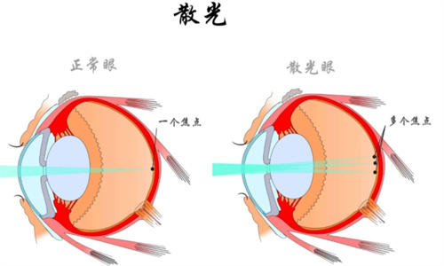 散光原理动画图