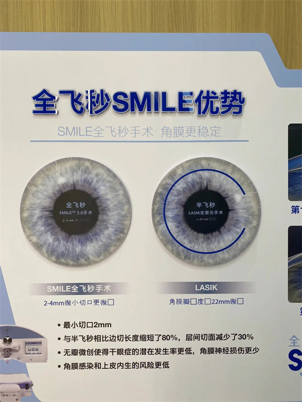 全飞秒SMILE优势