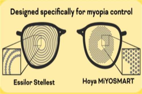 离焦镜片适合多少度近视？医生解答说适合0-600度的近视 散光度数在400度以内的儿童使用！