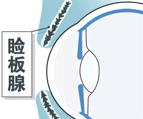 爱尔眼科睑板腺疏通价格:200~1000元不等,爱尔做睑板腺疏通技术好收费不贵!