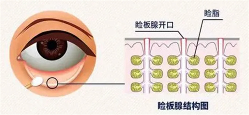 眼睑板结构图