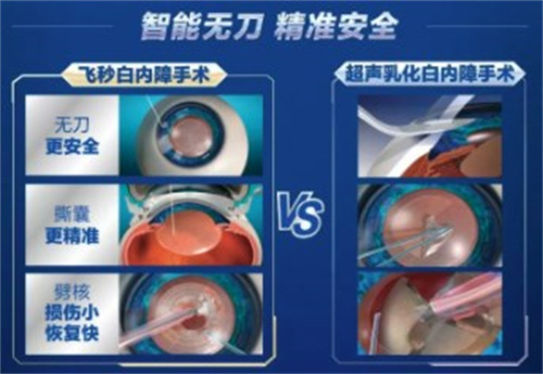 白内障去综合医院好还是爱尔好呢？白内障手术你们推荐去哪种医院？