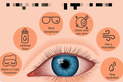 爱尔眼科干眼症治疗价格收费标准:轻度500+中度1000+重度2000+