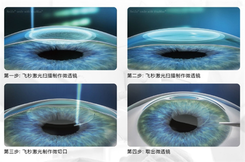 三亚眼科哪家好，三亚国爱近视治疗中心和明朗眼科很受欢迎！