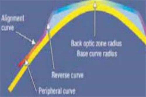 佩戴角膜塑形镜角膜受力示意图