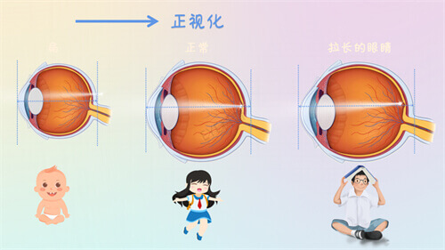 邯郸近视手术价格表2024年中盘点公示!现半飞/全飞/激光/ICL价格都不高~