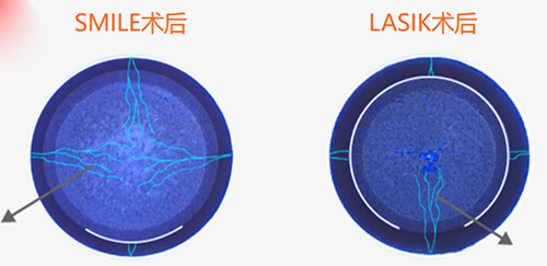 爱尔2024年价格一览表图片及价格大全解析!斜视/近视/弱视/白内障/青光眼/验配等收费标准均有~