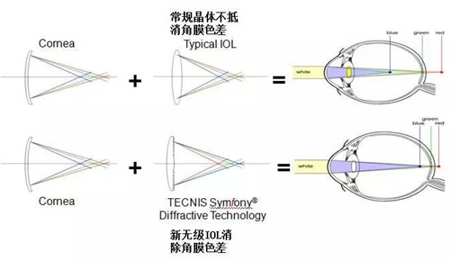 新无极人工晶体的优点