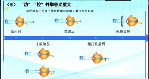 奥拉怒放近视管理镜片价位一览表!3500-5000元起一副,D.S.D.O设计更精密~